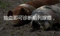 抽血即可诊断前列腺癌，拜登为何不测	？