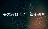头秃有救了？干细胞研究阐明压力如何影响毛发生长